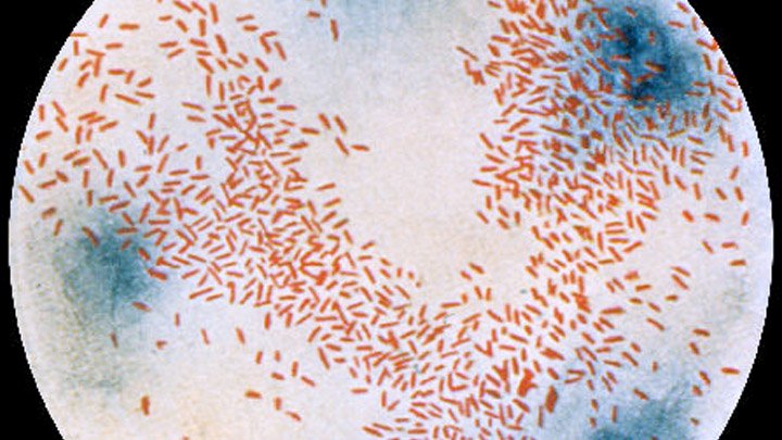 HAEMOPHILUS INFLUENZAE