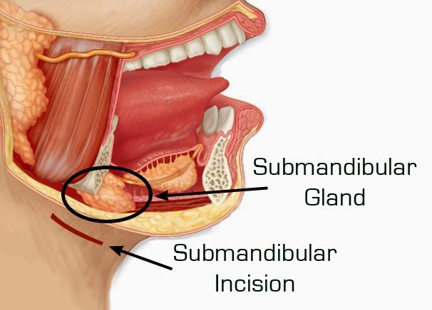 Resultado de imagen para GLÃNDULAÂ SUBMANDIBULAR